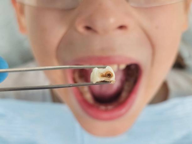 Best Emergency TMJ Treatment in San Augustine, TX